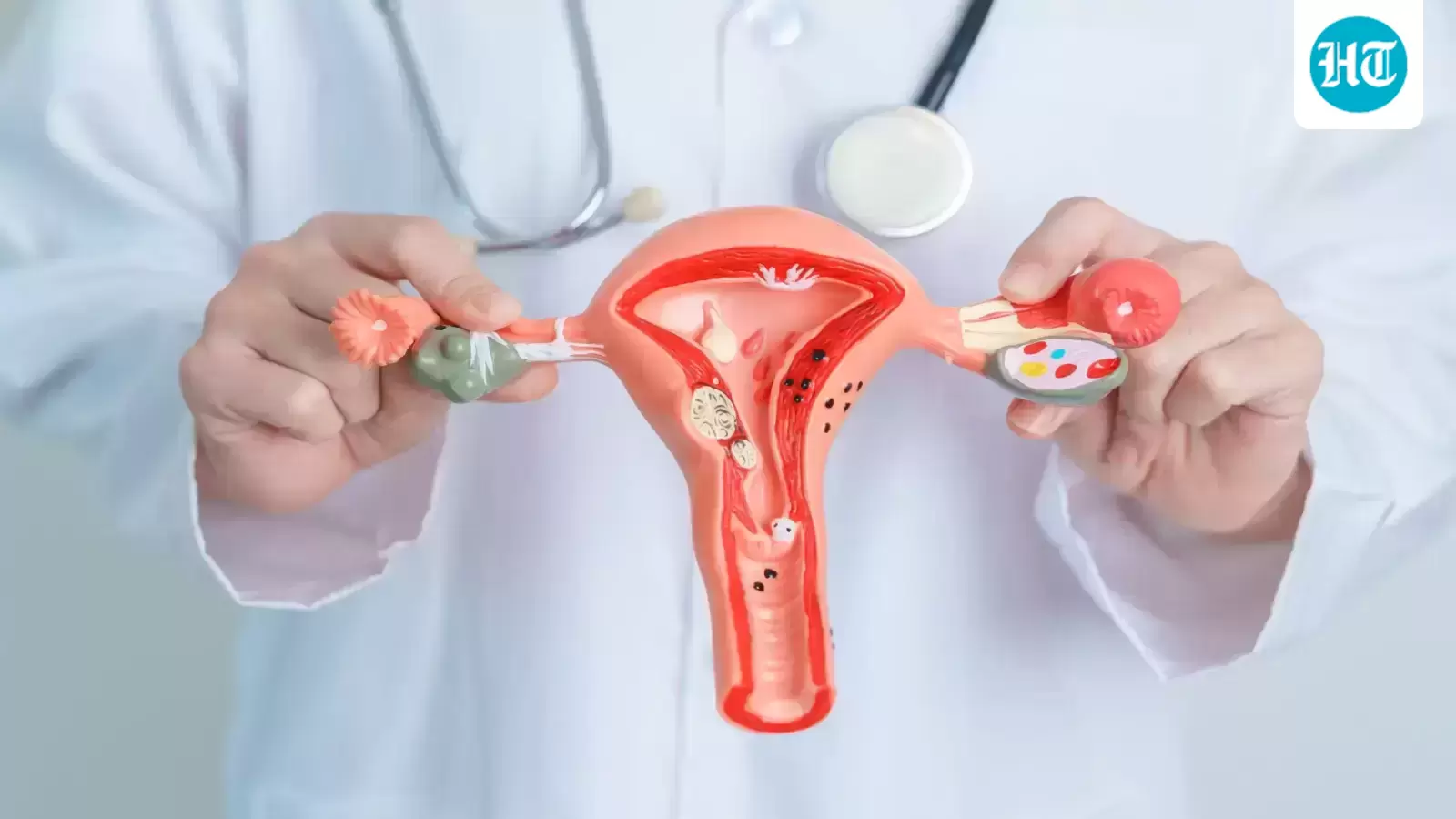 Can hormonal imbalances increase endometrial cancer risk? Gynaecologist explains the link between lifestyle and health