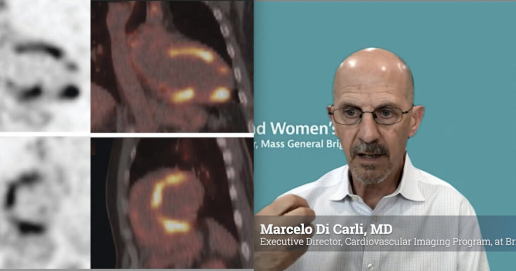 Nuclear cardiology expands beyond perfusion imaging as it enters a new era