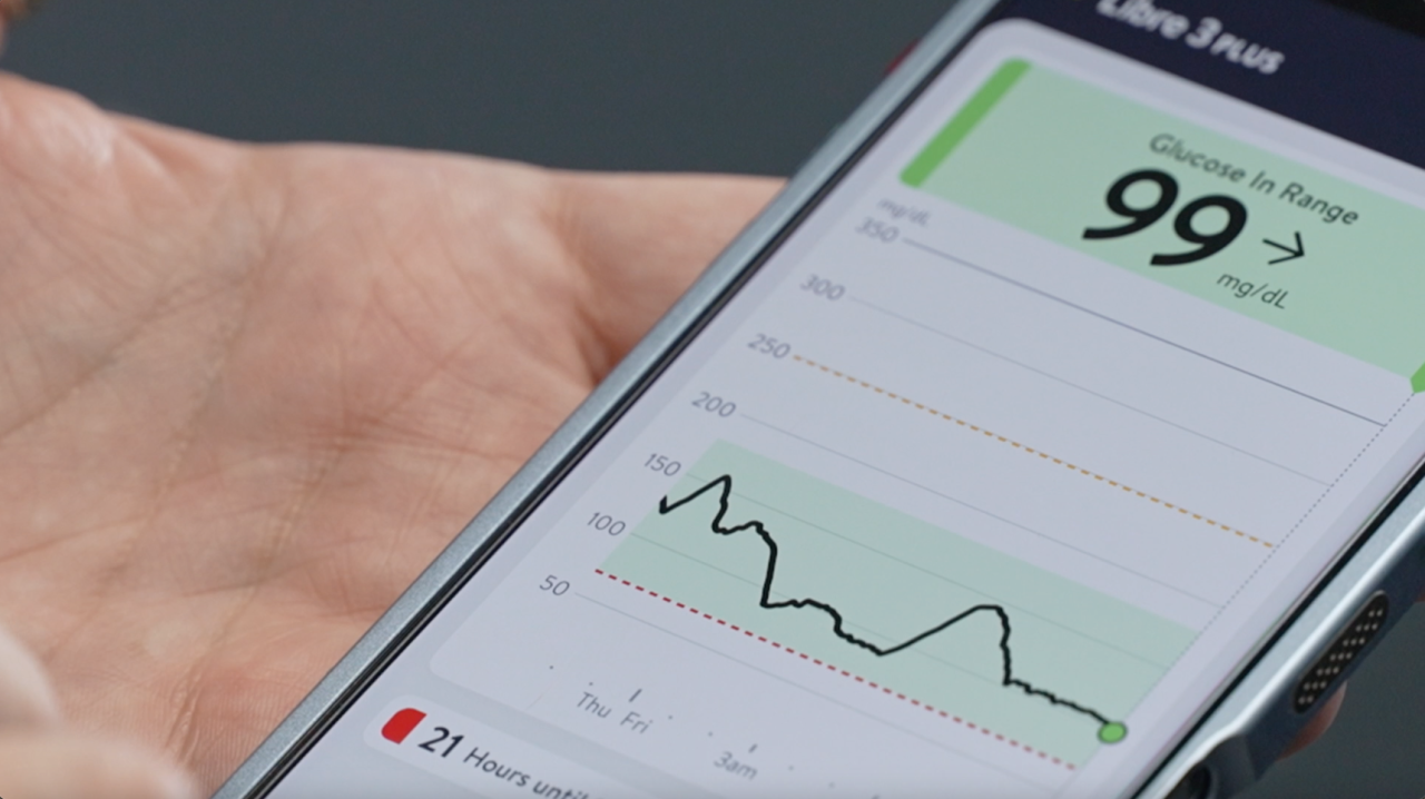 Nate Porter's continuous glucose monitor 